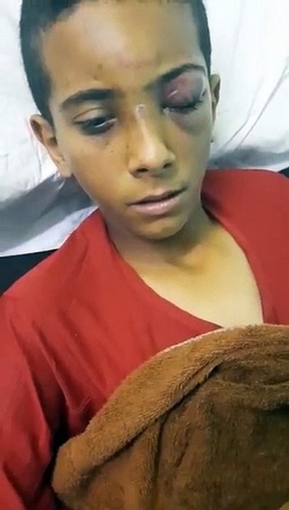 معلم يعتدي بشكل وحشي على طالب في اربد