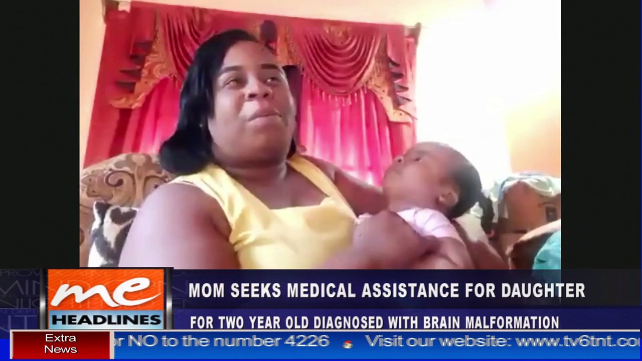 HELP BABY KAAMIYAH GET BRAIN SURGERY