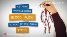 Ini Metode untuk Deteksi Gejala Stroke di Tubuh