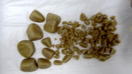 Golden cinsi köpeğin idrar kesesinden çıkanlar şoke etti