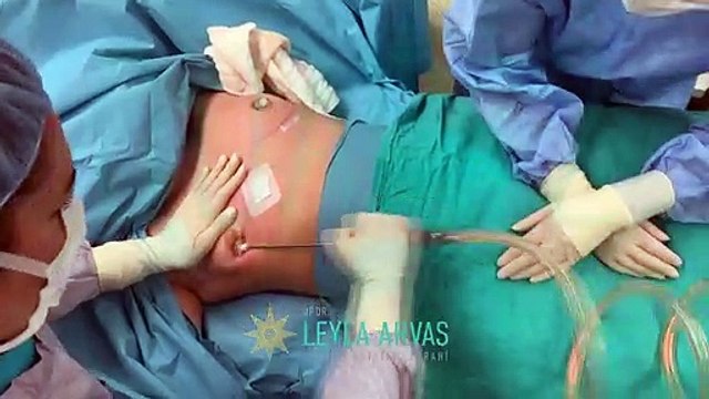 JİNEKOMASTİ AMELİYATI ÖNCESİ BİLİNMESİ GEREKENLER_! (2)