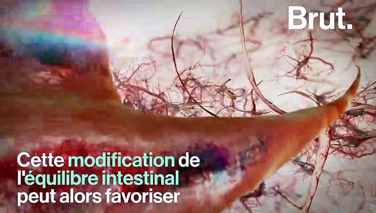 Ces maladies du cerveau liées à l'alimentation