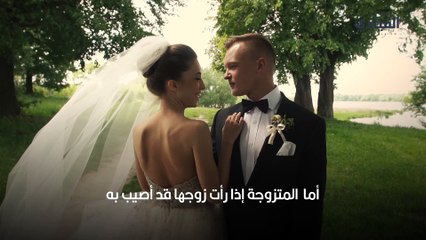 رجل أصلع في المنام_ ما تفسير هذه الرؤية؟