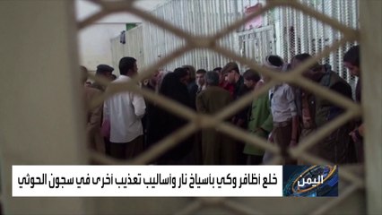 خلع أظافر وكي بالنار.. شهادات تكشف وحشية الحوثي بتعذيب المعتقلين