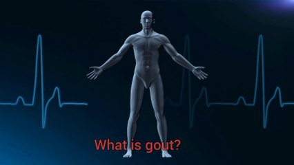 Gout | Anthritis | What causes it?