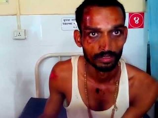 सप्तश्रृंगी देवीच्या दर्शनासाठी जाणाऱ्या गाडीला अपघात, जखमींवर उपचार सुरु