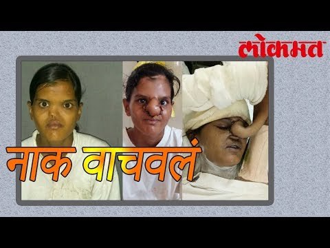 असं करून तिनं नाक वाचवलं | OMG News In Marathi | Lokmat Marathi News | लोकमत मराठी न्यूज