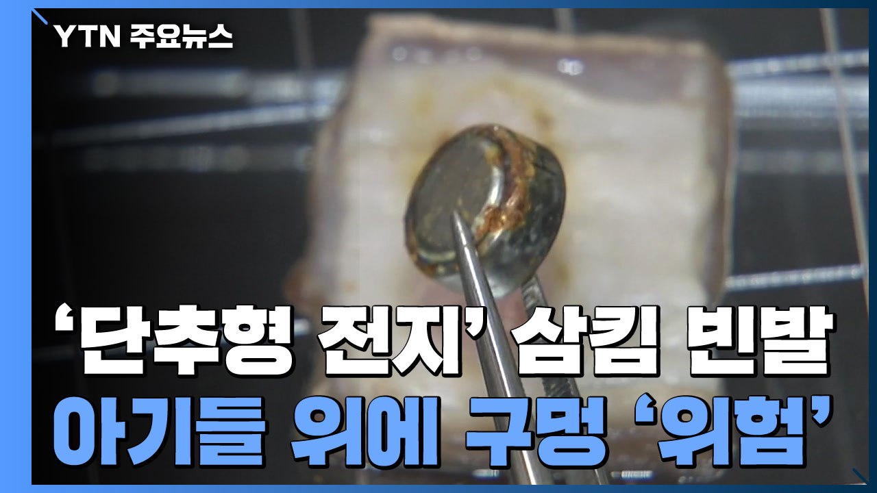 아기 '단추형 전지' 삼킴사고 빈발..."위에 구멍날 수도" / YTN
