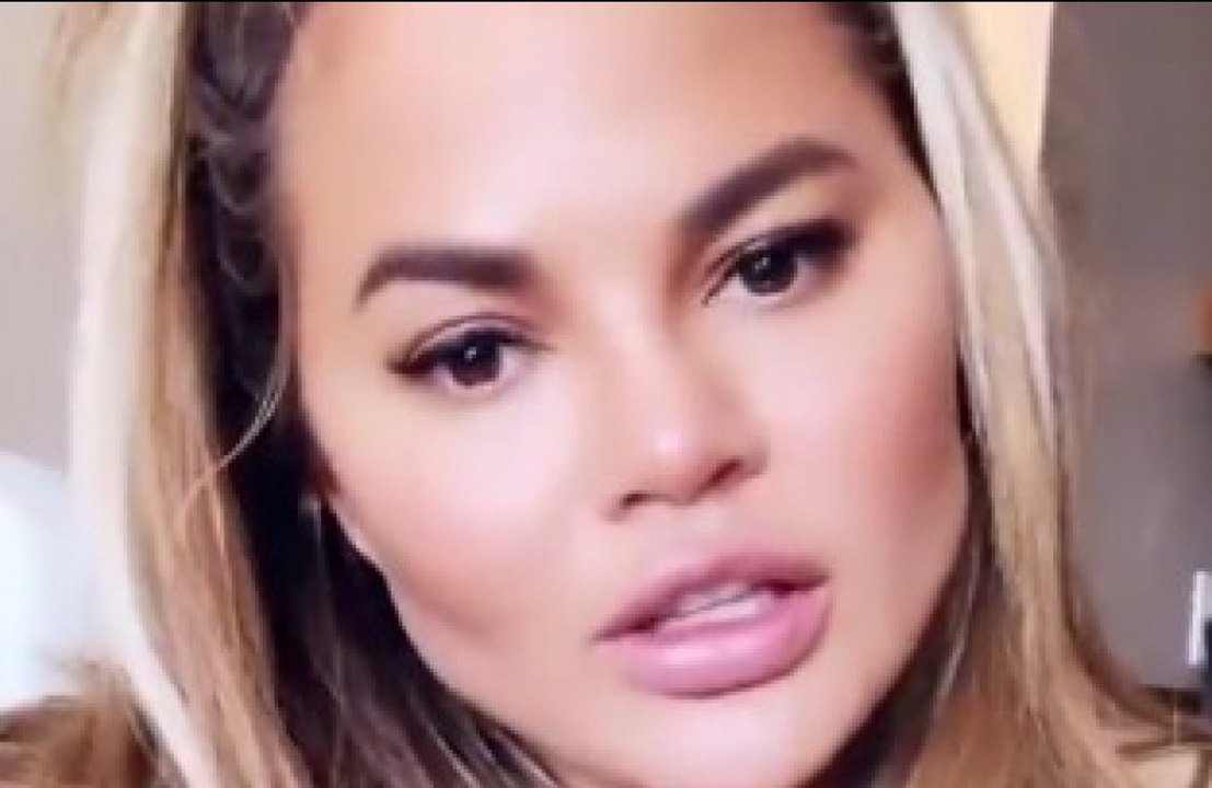 Chrissy Teigen hat sich Fett absaugen lassen