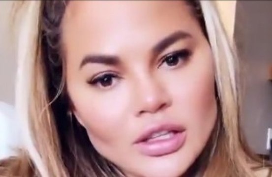 Chrissy Teigen hat sich Fett absaugen lassen