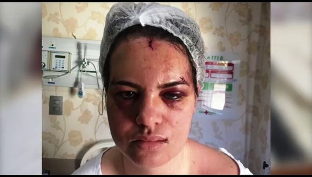 Eles estão me expulsando de casa com a minha filha de sete anos , diz mulher agredida por dentista