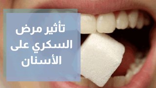 تأثير مرض السكري على الأسنان وصحة الفم