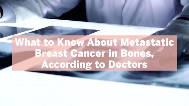 What to Know About Metastatic Breast Cancer in Bones, According to Doctors