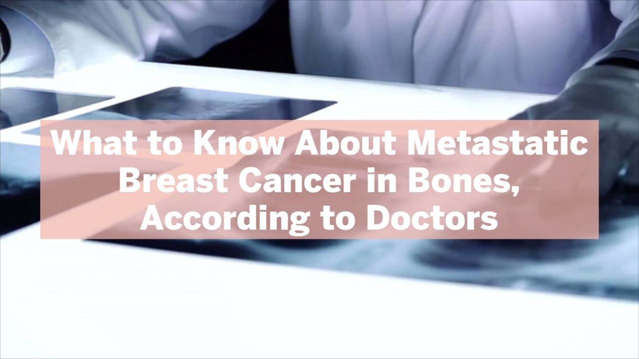 What to Know About Metastatic Breast Cancer in Bones, According to Doctors