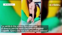 Dan Sur, ecco il rapper messicano che si è fatto impiantare catene d'oro al posto dei capelli