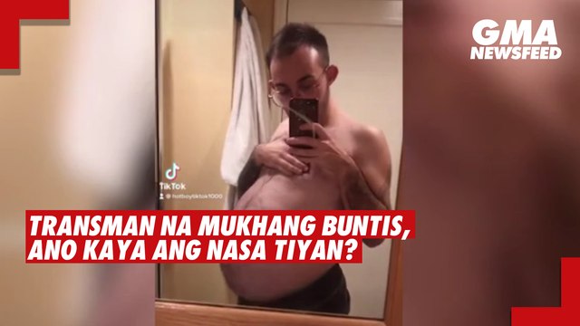 Transman na mukhang buntis, ano kaya ang nasa tiyan? | GMA News Feed
