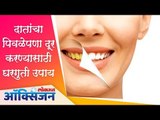 दातांचा पिवळेपणा दूर करण्यासाठी घरगुती उपाय  | How To Whitening Your Teeth Naturally | Lokmat Oxygen