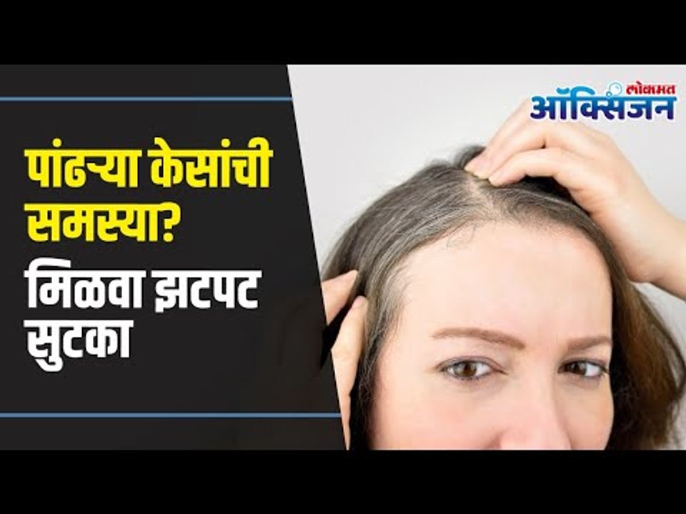 Get Rid Of Grey Hair | White Hair to Black Hair Naturally |पांढऱ्या केसांची समस्या? मिळवा झटपट सुटका