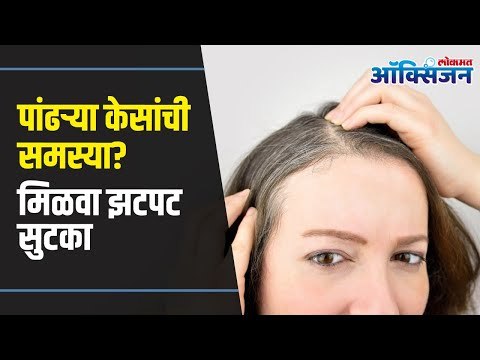 Get Rid Of Grey Hair | White Hair to Black Hair Naturally |पांढऱ्या केसांची समस्या? मिळवा झटपट सुटका