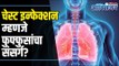 Cure Chest Infection Naturally। Lungs Infection | चेस्ट इन्फेक्शन म्हणजे फुफ्फुसांचा संसर्ग ?