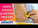 कोपरांचा काळपटपणा दूर करण्यासाठी घरगुती उपाय | Remove Dark Knees and Elbows | Lokmat Oxygen