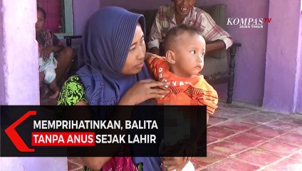 Memprihatinkan Balita Tanpa Anus Sejak Lahir