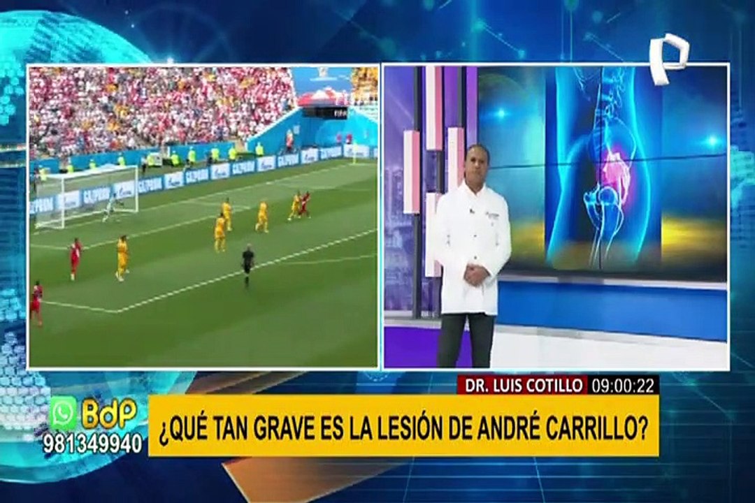 ¿Carrillo podrá jugar en la Selección tras lesión de espalda? especialista explica su situación