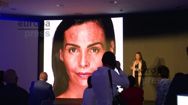 Inés Sastre presenta un nuevo tratamiento médico despigmentante