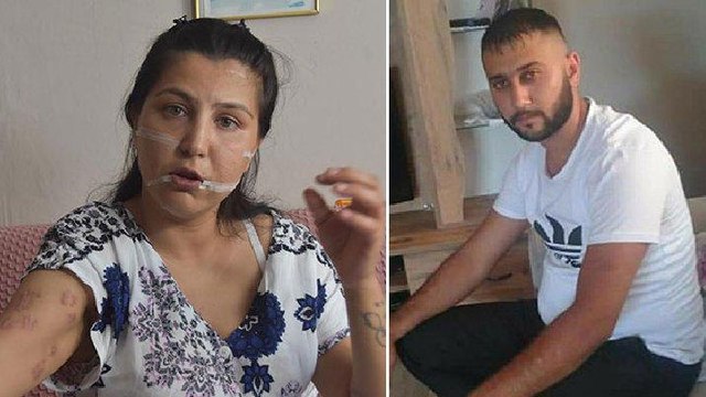 Eşi 104 defa bıçakladı, genç kadın dehşeti anlattı…