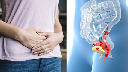 Stomach से जुड़ी ये बीमारी है बेहद खतरनाक ,जानिए Symptoms और उपाय । Boldsky