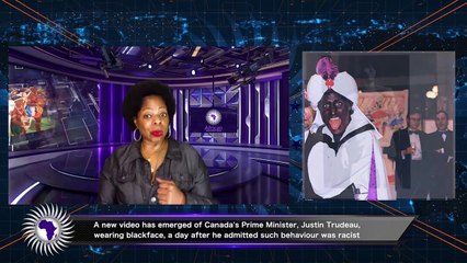 Another Blk Face Photo Of Canada's Prime Minister Surfaces