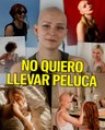 ¿Cómo es vivir con alopecia femenina?