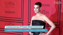 Supermodel Linda Evangelista Has Been 'Brutally Disfigured' by Procedure Done 5 Years Ago _ PEOPLE
