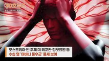 [30초뉴스] 미 정보원들 '아바나 괴질' 공포…