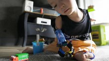 Lego-Prothese hilft Achtjährigem im Alltag