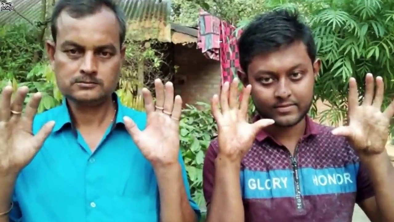 ১টি উটপাখির ডিমে থাকে ২০০০ ক্যালরি শক্তি যা ১টি মুরগির ডিমের ২৭ গুণ... আমরা খাইন