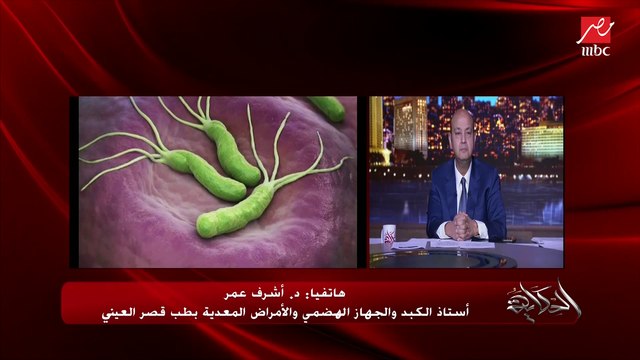 د. أشرف عمر أستاذ الكبد والجهاز الهضمي يشرح خطورة جرثومة المعدة: نص سكان العالم عندهم الجرثومة ومضاعفاتها تؤدي لسرطان المعدة أو الغدد الليمفاوية