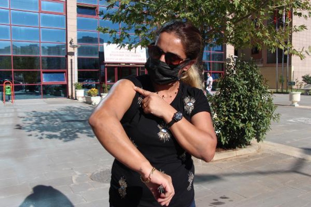 GÜZELLİK MERKEZİNDE LAZER İŞLEMİ YAPTIRDI, KOLLARI VE BACAĞI YANDI