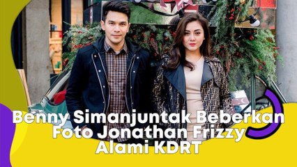 Benny Simanjuntak Beberkan Foto Jonathan Frizzy Alami KDRT, Netizen Ngeri