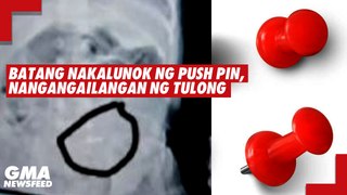 Batang nakalunok ng push pin, nangangailangan ng tulong | GMA News Feed
