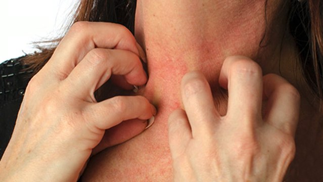 bd-picazon-piel-280921