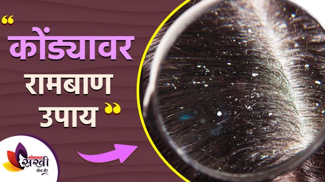 केसातील कोंडा घालवण्यासाठी रामबाण उपाय | How to Get Rid of Dandruff DIY Permanently | Lokmat Sakhi