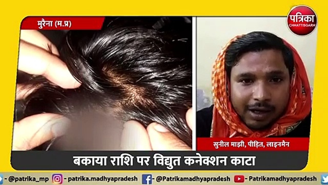 बकाया राशि न चुकाने पर बिजली कंपनी ने काटा कनेक्शन, उपभोक्ता ने लाइनमैन का फोड़ा दिया सिर