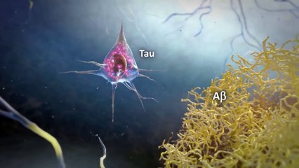 ConsulTV - Prevención y Atención de la Enfermedad Alzheimer y Tuberculosis.