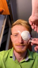 What an Eye Can Look Like After Eye Surgery