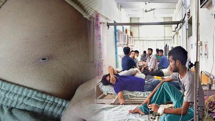 India में जानलेवा Scrub Typhus तेजी से फैला, Mystery Fever Symptoms चौंकाने वाला | Boldsky