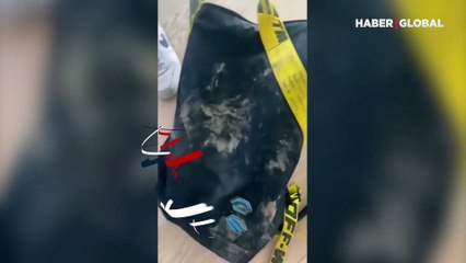 Ünlü yıldıza büyük şok! Parkta yaban domuzlarının saldırısına uğradı