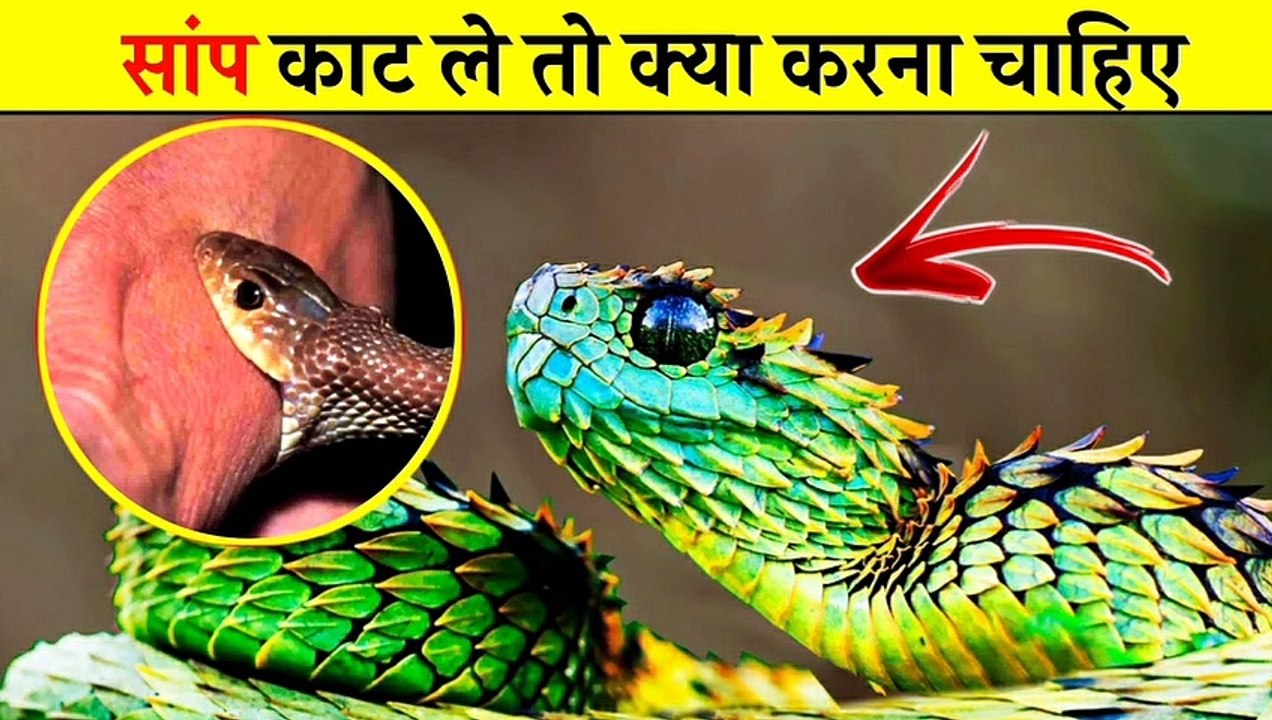 सांप काट ले तो क्या करना चाहिए ?  | What To Do If A Snake Bites 
