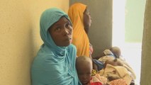 Doctors in Nigeria struggle to cope as acute malnutrition soars