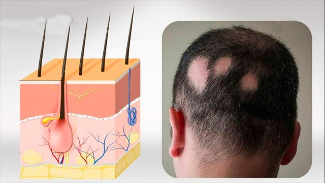 bd-protocolo-capilar-para-restaurar-cuero-cabelludo-011021